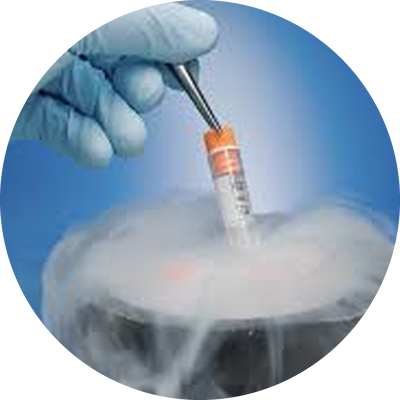 criobiolab-crioconservazione Crioconservazione in azoto liquido