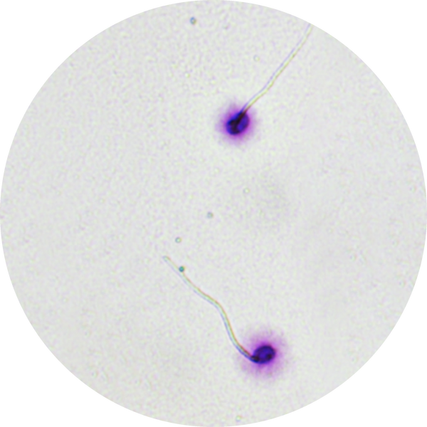criobiolab-spermatozoi Spermatozoi al microscopio